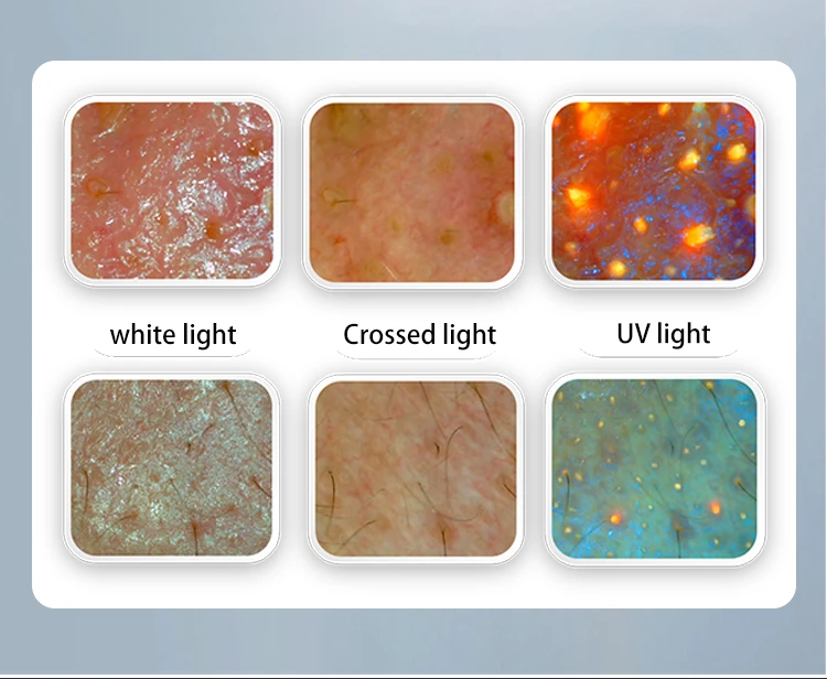 Al Skin Analyzer Machine high quality